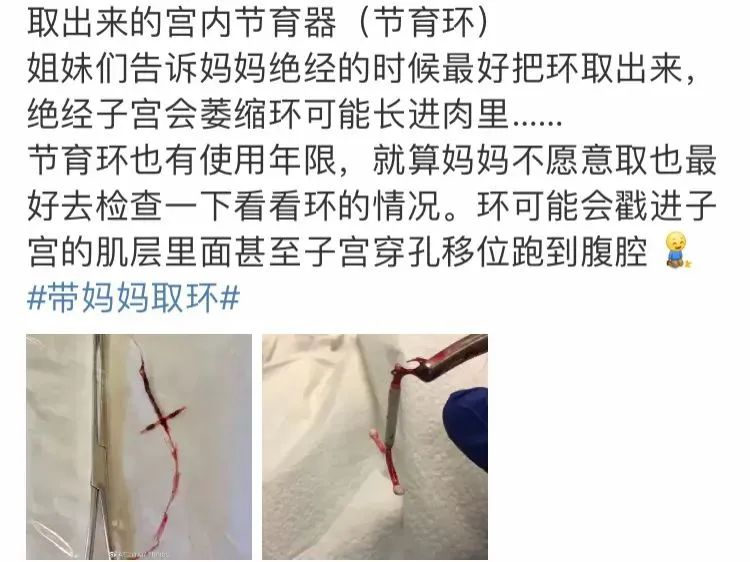 “哺乳期上环擦边女”:情色play的狂欢,太恶心了!